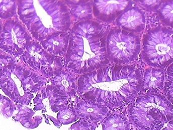 Citopatología de Tamiz