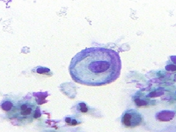 citopatologia-celula